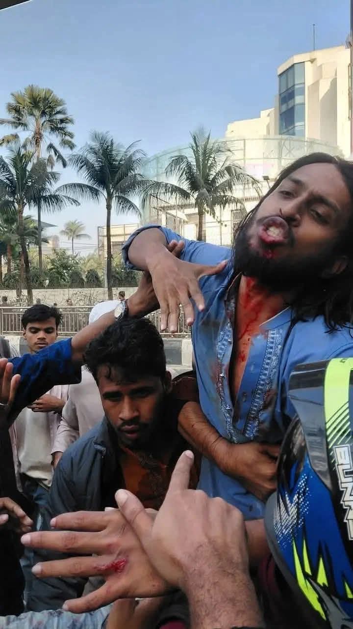 পুলিশের সাথে ইনকিলাব মঞ্চের সংঘর্ষে জাবেরসহ গুলিবিদ্ধ একাধিক<br>