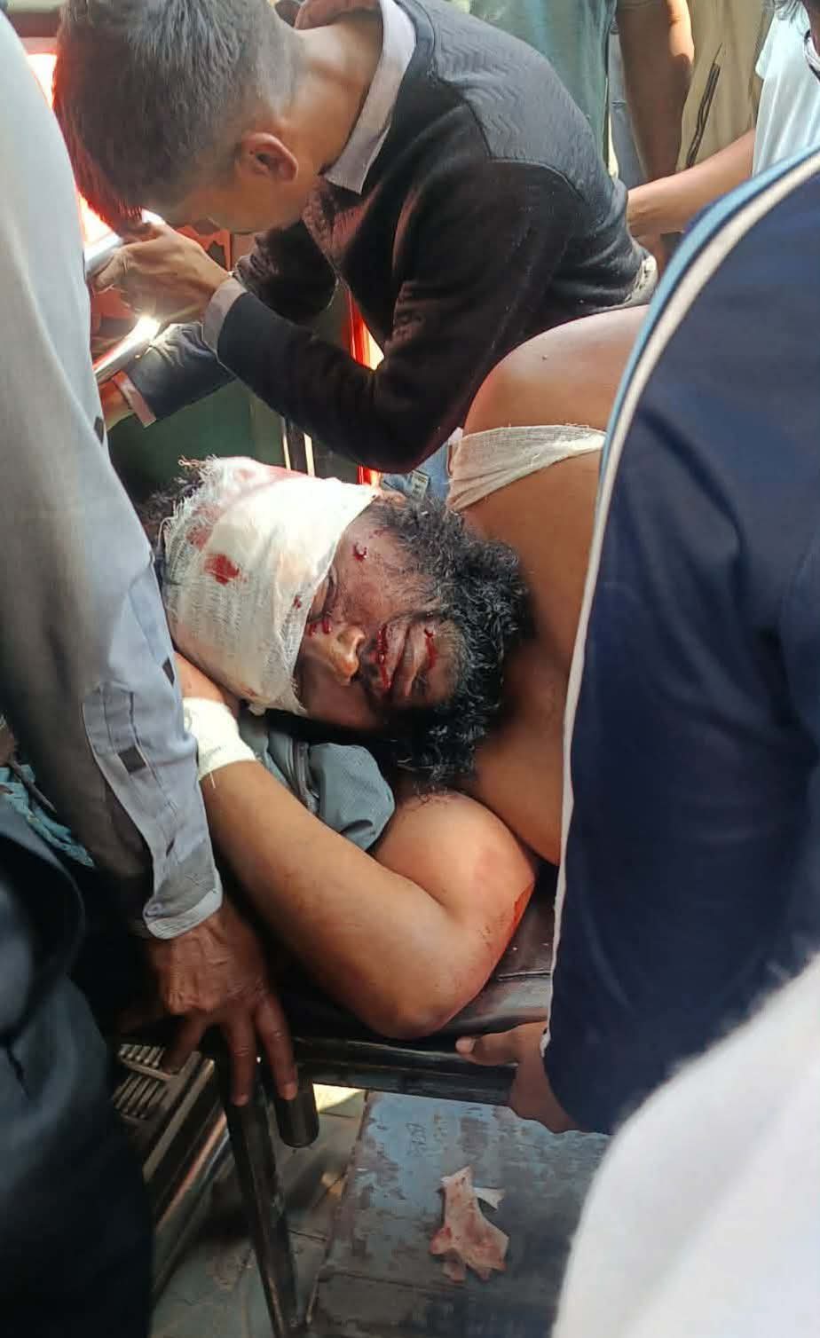 নাটোরের বড়াইগ্রামে নির্বাচন-পরবর্তী সহিংসতা